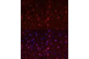 Immunofluorescence analysis of rat brain using SLC1 antibody (ABIN6131630, ABIN6147868, ABIN6147869 and ABIN6219899) at dilution of 1:100. (SLC1A1 anticorps  (AA 430-524))