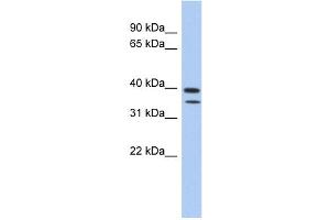 WB Suggested Anti-C4orf23 Antibody Titration: 0.