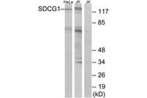 Western blot analysis of extracts from HeLa/Jurkat cells, using SDCG1 Antibody. (NEMF anticorps  (AA 881-930))