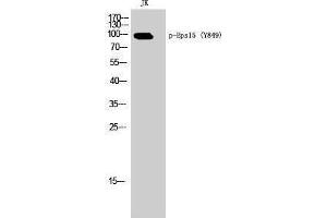 Western Blotting (WB) image for anti-Epidermal Growth Factor Receptor Pathway Substrate 15 (EPS15) (pTyr849) antibody (ABIN3182362)