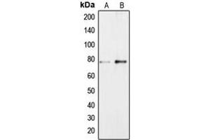 Western blot analysis of BRF1 expression in Jurkat (A), NIH3T3 (B) whole cell lysates. (BRF1 anticorps  (Center))