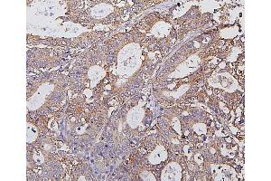 IHC analysis of Hexokinase 1/HK1 using anti-Hexokinase 1/HK1 antibody (ABIN7600260). (Hexokinase 1 anticorps  (AA 17-323))