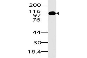 Image no. 1 for anti-DEAD (Asp-Glu-Ala-Asp) Box Polypeptide 58 (DDX58) (AA 1-220) antibody (ABIN5027274) (DDX58 anticorps  (AA 1-220))