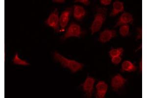 ABIN6269009 staining LOVO by IF/ICC. (SLC2A3 anticorps  (C-Term))