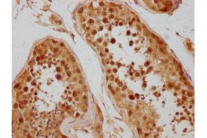 IHC image of ABIN7152321 diluted at 1:300 and staining in paraffin-embedded human testis tissue performed on a Leica BondTM system.