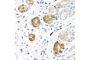 Immunohistochemistry of paraffin-embedded human stomach using SGSH antibody at dilution of 1:100 (40x lens). (SGSH anticorps)