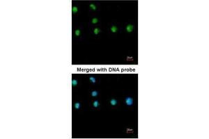 ICC/IF Image Immunofluorescence analysis of paraformaldehyde-fixed HeLa, using COUP TF1 , antibody at 1:200 dilution. (NR2F1 anticorps  (N-Term))