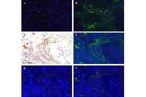 IF Validation of SARS-CoV2 Spike in COVID-19 Patient Lung (Source: Magro et al.