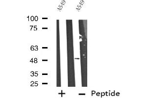 Western blot analysis of extracts from A549 cells, using Cytochrome P450 17A1 antibody. (CYP17A1 anticorps  (Internal Region))