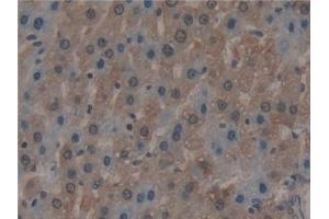 anti-Myxovirus Resistance Protein 1 (MX1) (AA 68-303) antibody