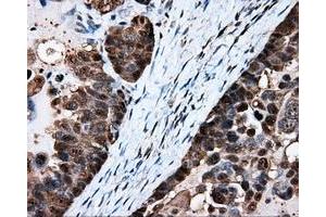 Immunohistochemical staining of paraffin-embedded Kidney tissue using anti-HSPA1A mouse monoclonal antibody. (HSP70 1A anticorps)