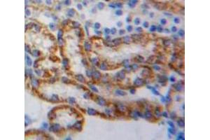 Used in DAB staining on fromalin fixed paraffin-embedded Kidney tissue (NDUFAB1 anticorps  (AA 3-129))