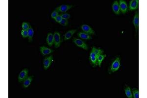 Immunofluorescent analysis of HepG2 cells using ABIN7157756 at dilution of 1:100 and Alexa Fluor 488-congugated AffiniPure Goat Anti-Rabbit IgG(H+L)