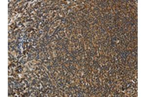 The image on the left is immunohistochemistry of paraffin-embedded Human tonsil tissue using ABIN7130557(PCP4 Antibody) at dilution 1/50, on the right is treated with fusion protein.