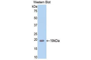 Western Blotting (WB) image for anti-serpin Peptidase Inhibitor, Clade A (Alpha-1 Antiproteinase, Antitrypsin), Member 6 (SERPINA6) (AA 106-255) antibody (ABIN1858273)