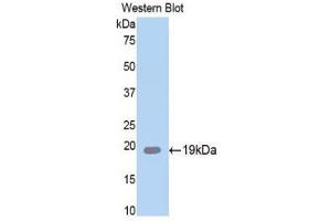 Western Blotting (WB) image for anti-serpin Peptidase Inhibitor, Clade A (Alpha-1 Antiproteinase, Antitrypsin), Member 6 (SERPINA6) (AA 106-255) antibody (ABIN1858273) (SERPINA6 anticorps  (AA 106-255))