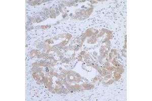 Immunohistochemistry (IHC) image for anti-Cystathionine-beta-Synthase (CBS) (AA 1-50) antibody (ABIN7453425)