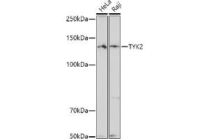 Western blot analysis of extracts of various cell lines, using TYK2 antibody (ABIN3022987, ABIN3022988, ABIN3022989 and ABIN6219333) at 1:500 dilution.