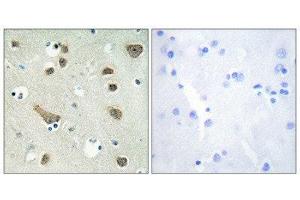 Immunohistochemistry (IHC) image for anti-14-3-3 gamma (YWHAG1) (Internal Region) antibody (ABIN1850146)