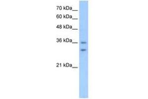 Image no. 1 for anti-Olfactory Receptor, Family 6, Subfamily C, Member 70 (OR6C70) (C-Term) antibody (ABIN205050) (OR6C70 anticorps  (C-Term))