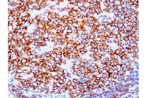 Formalin-fixed, paraffin-embedded human Tonsil stained with CD20 Rabbit Recombinant Monoclonal Antibody (IGEL/1497R). (Recombinant CD20 anticorps)