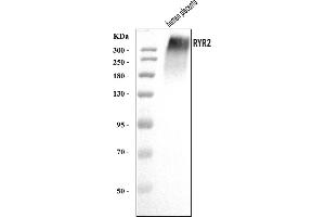 Western blot analysis of RYR2 using anti-RYR2 antibody (ABIN7599921).