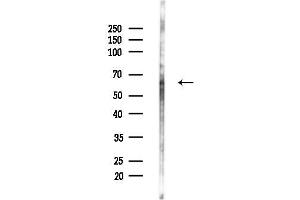 anti-Cas-Br-M (Murine) Ecotropic Retroviral Transforming Sequence-Like 1 (CBLL1) (C-Term) antibody