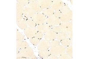 Immunohistochemistry of paraffin embedded mouse Skeletal muscle using CITED4 (ABIN7073356) at dilution of 1:2200 (400x lens)