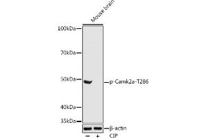 Western blot analysis of extracts of Mouse brain, using Phospho-Camk2a-T286 antibody (ABIN3019946, ABIN3019947, ABIN3019948 and ABIN1681430) at 1:1000 dilution.