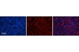 Rabbit Anti-DHX30 Antibody      Formalin Fixed Paraffin Embedded Tissue: Human Adult Liver   Observed Staining: Cytoplasm in hepatocytes, moderate signal, wide tissue distribution  Primary Antibody Concentration: 1:100  Secondary Antibody: Donkey anti-Rabbit-Cy3  Secondary Antibody Concentration: 1:200  Magnification: 20X  Exposure Time: 0.