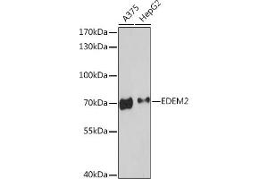 Western blot analysis of extracts of various cell lines, using EDEM2 Rabbit pAb (ABIN7267004) at 1:3000 dilution. (EDEM2 anticorps  (AA 399-578))