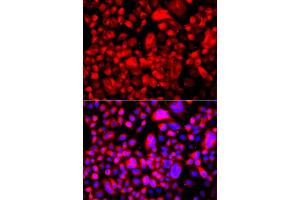 Immunofluorescence analysis of A549 cell using FASN antibody. (Fatty Acid Synthase anticorps)