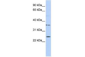 WB Suggested Anti-IQCF1 Antibody Titration: 0. (IQCF1 anticorps  (Middle Region))