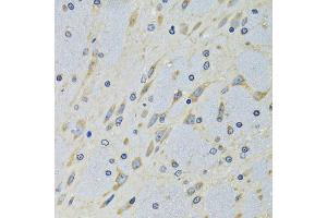 Immunohistochemistry of paraffin-embedded mouse brain using DARS antibody (ABIN5973949) at dilution of 1/100 (40x lens). (DARS anticorps)
