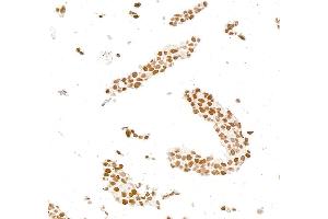 Immunocytochemistry (ICC) image for anti-Androgen Receptor (AR) (AA 1-50) antibody (ABIN7795784)