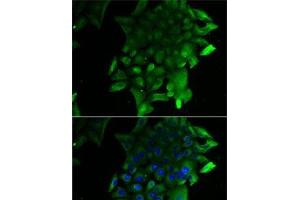 Immunofluorescence analysis of U2OS cells using SEPSECS Polyclonal Antibody
