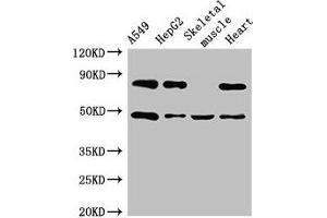 Western Blot Positive WB detected in: A549 whole cell lysate, HepG2 whole cell lysate, Mouse skeletal muscle tissue, Rat heart tissue All lanes: ASB4 antibody at 3 μg/mL Secondary Goat polyclonal to rabbit IgG at 1/50000 dilution Predicted band size: 49, 39 kDa Observed band size: 49 kDa (ASB4 anticorps  (AA 166-321))
