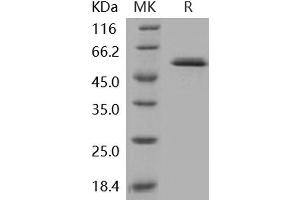 Western Blotting (WB) image for Glucokinase (Hexokinase 4) (GCK) protein (ABIN7317079) (GCK Protéine)