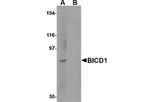 Western Blotting (WB) image for anti-Bicaudal D Homolog 1 (BICD1) (C-Term) antibody (ABIN1030294) (BICD1 anticorps  (C-Term))