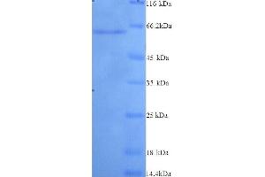 Matrix Metalloproteinase 2 (MMP2) (AA 110-662), (full length) protein (His tag) (MMP2 Protein (AA 110-662, full length) (His tag))