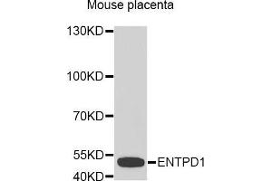 Western Blotting (WB) image for anti-Ectonucleoside Triphosphate diphosphohydrolase 1 (ENTPD1) (AA 1-180) antibody (ABIN1679729) (CD39 anticorps  (AA 1-180))