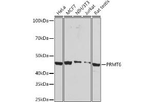 Western blot analysis of extracts of various cell lines, using PRMT6 Rabbit mAb (ABIN7269606) at 1:1000 dilution.