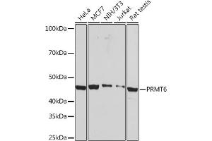 Western blot analysis of extracts of various cell lines, using PRMT6 Rabbit mAb (ABIN7269606) at 1:1000 dilution. (PRMT6 anticorps)