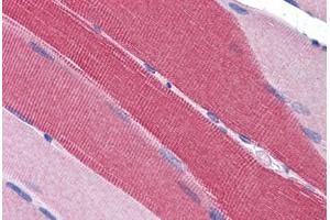 Human Skeletal Muscle: Formalin-Fixed, Paraffin-Embedded (FFPE) (PDE4D anticorps  (AA 796-809))