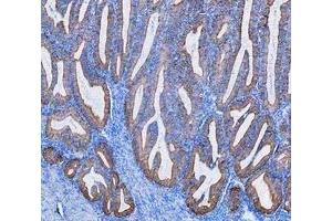 IHC analysis of Cytokeratin 8/KRT8 using anti-Cytokeratin 8/KRT8 antibody (ABIN5518853).