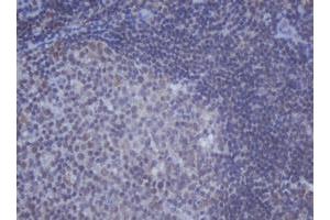 anti-DEAD (Asp-Glu-Ala-Asp) Box Polypeptide 59 (DDX59) (AA 1-303) antibody