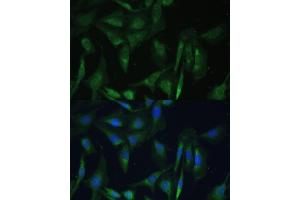Immunofluorescence analysis of U-2 OS cells using CAMLG Polyclonal Antibody (ABIN6129359, ABIN6137896, ABIN6137897 and ABIN6217819) at dilution of 1:100 (40x lens).