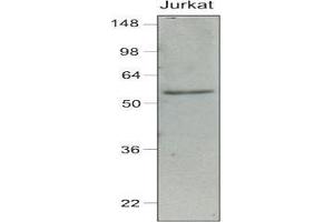 Cell lysates of Jurkat (40 ug) were resolved by SDS-PAGE, transferred to nitrocellulose membrane and probed with anti-human IRF-7 (1:1,000). (IRF7 anticorps  (AA 1-150))