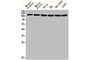 Western blot analysis of Mouse-kidney mouse-brain HELA KB SH-SY5Y 293T lysis using GCP5 antibody. (TUBGCP5 anticorps  (Internal Region))