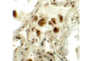 Immunohistochemical staining of human lung cells with RASSF10 polyclonal antibody  at 5 ug/mL. (RASSF10 anticorps  (N-Term))